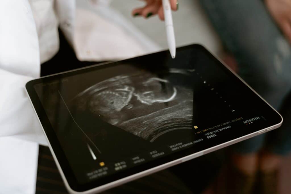 Tablet with ultrasound image