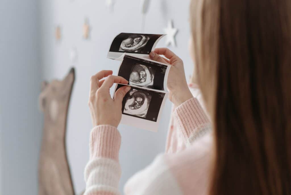 Woman looking at ultrasound images of baby